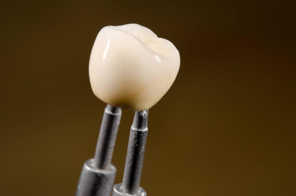 dental crown being held by dental tools