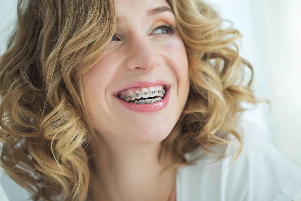 woman smiling wearing traditional orthodontics