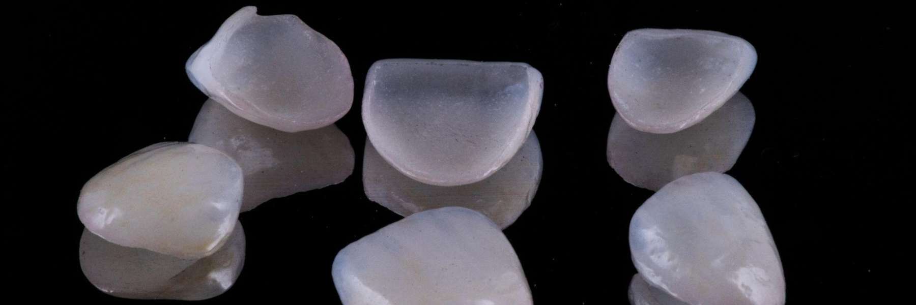 Dental Veneers in Casuarina, NT