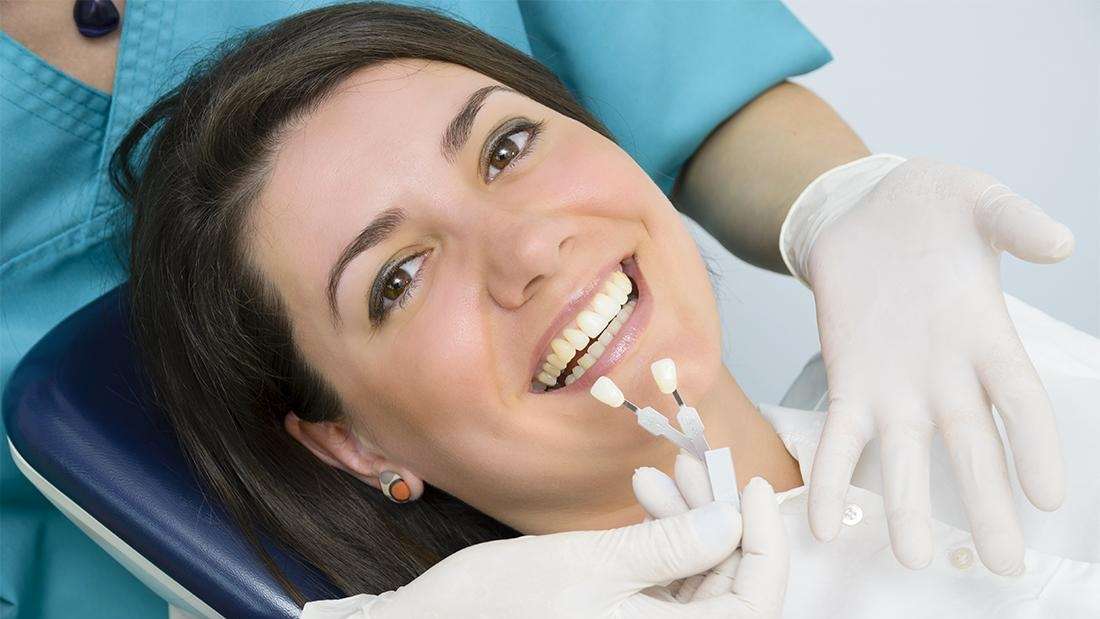 How to Care for Your Dental Veneers Dental Veneers Darwin NT