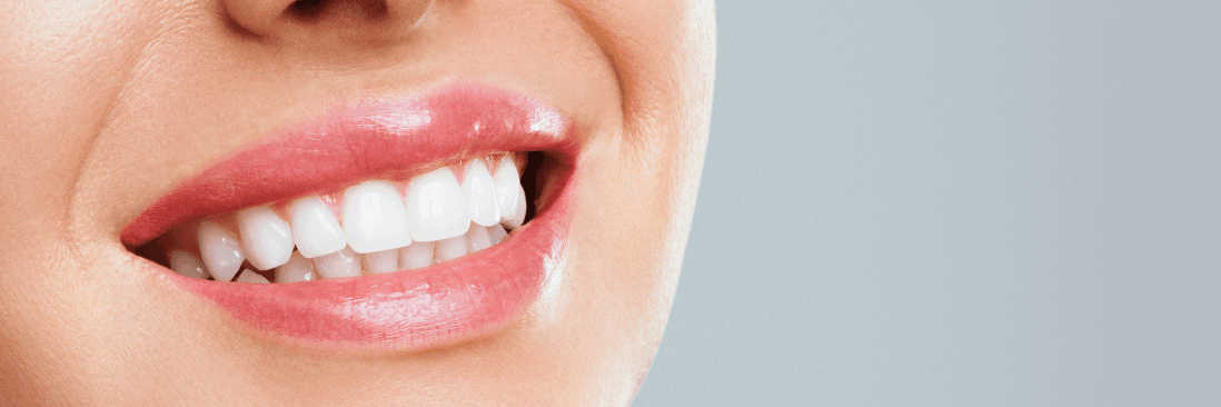 healthy smile of a woman after dental cleaning in Darwin