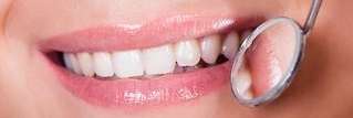 close up of patient's smile reflected in a dental mirror