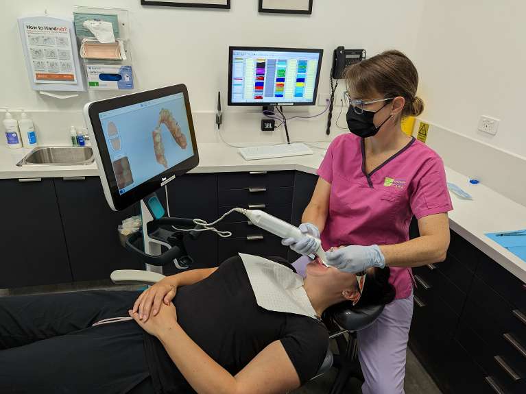 Itero Intraoral Scanner